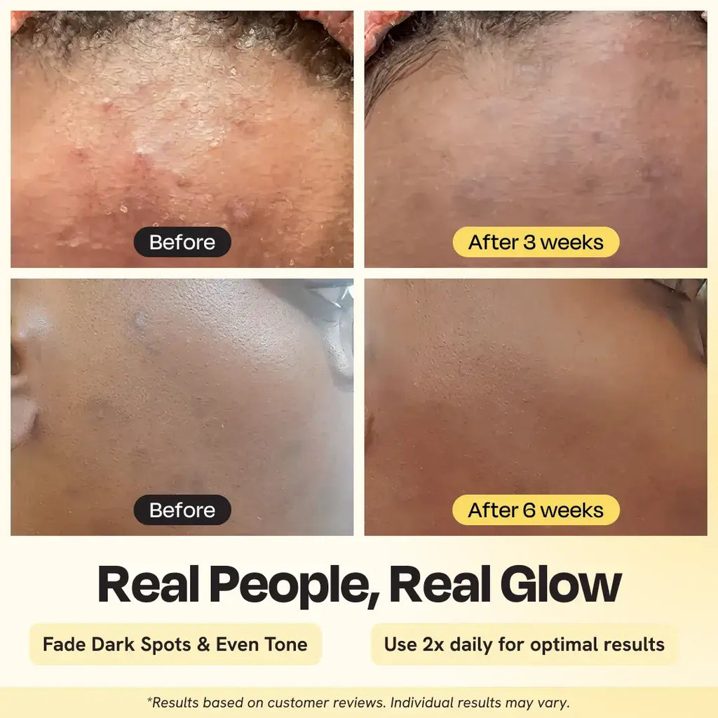 Image showing results of Advanced Brightening Moisturizer after 3 and 6 weeks, highlighting improved skin tone.