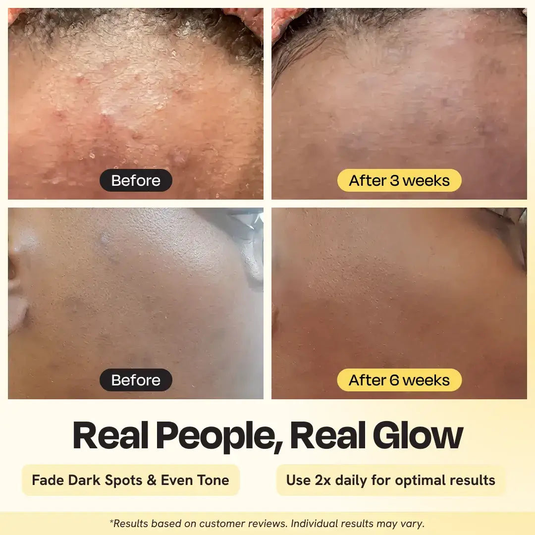 Image showing results of Advanced Brightening Moisturizer after 3 and 6 weeks, highlighting improved skin tone.